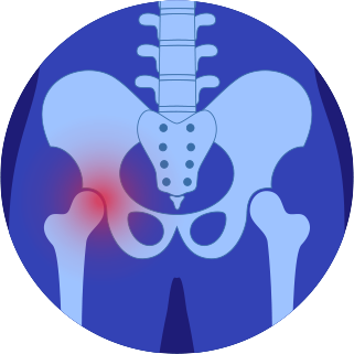 Hip pain treatment | Hip Pain Treatment Plan | Hip Pain Therapy